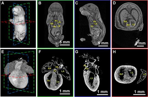 Three-dimensional microCT imaging of mouse heart development from early post-implantation to late fetal stages.