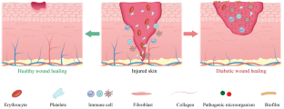 Role of exosome-derived miRNAs in diabetic wound angiogenesis.