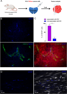 Tissue-resident glial cells associate with tumoral vasculature and promote cancer progression