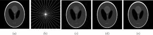 Efficient dual ADMMs for sparse compressive sensing MRI reconstruction