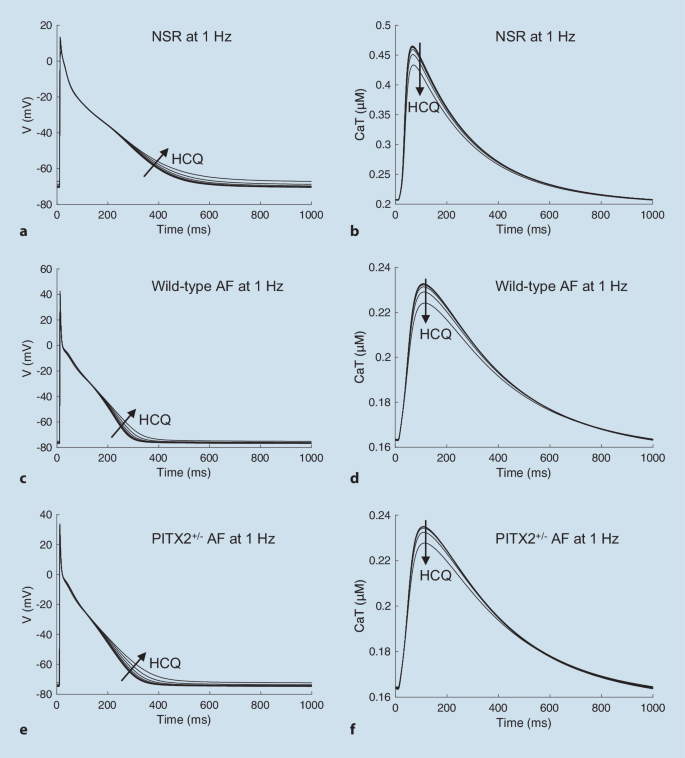 Effects of hydroxychloroquine on atrial electrophysiology in in silico wild-type and PITX2<sup>+/-</sup> atrial cardiomyocytes.