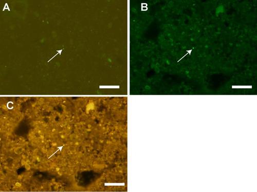 Accessing the energy-limited and sparsely populated deep biosphere: achievements and ongoing challenges of available technologies