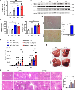 Inhibitor of nuclear factor kappa B kinase subunit epsilon regulates murine acetaminophen toxicity via RIPK1/JNK.