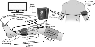 Novel Peripheral Perfusion Dynamics Indices for Detecting and Grading Arterial Stenosis.