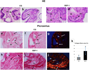 Stromal cell-derived factor 1 (SDF-1) increases the number of telocytes in ex vivo and in vitro assays.