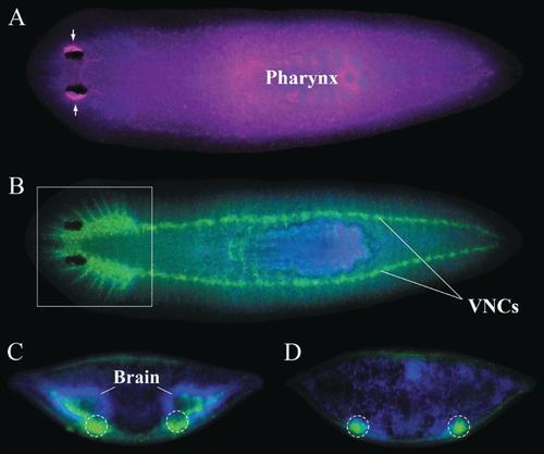 Why study sleep in flatworms?