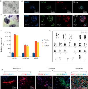 Generation of an Induced Pluripotent Stem Cell Line, ICGi043-A, by Reprogramming Peripheral Blood Mononuclear Cells from a Parkinson’s Disease Patient with p.G2019S Mutation in the LRRK2 Gene