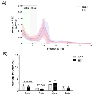 Increased Delta and Theta Power Density in Sickle Cell Disease Individuals with Chronic Pain Secondary to Hip Osteonecrosis: A Resting-State Eeg Study.