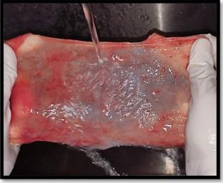 Evaluation on the efficacy of processed hydrated and dehydrated amnion chorion membrane on the proliferation of periodontal ligament fibroblasts.