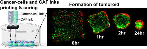 Inkjet-printed morphogenesis of tumor-stroma interface using bi-cellular bioinks of collagen-poly(N-isopropyl acrylamide-co-methyl methacrylate) mixture.