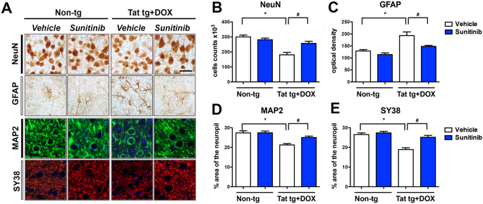 Correction to: The anti-cancer drug Sunitinib promotes autophagy and protects from neurotoxicity in an HIV-1 Tat model of neurodegeneration. Journal of NeuroVirology 2017.