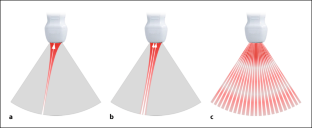 [Echocardiography with high frame rates in the clinical practice : Principles, applications and perspectives].