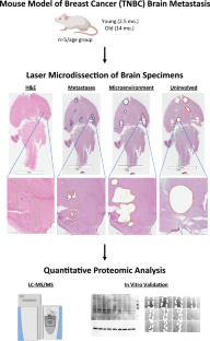 The murine metastatic microenvironment of experimental brain metastases of breast cancer differs by host age in vivo: a proteomic study.