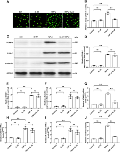 IL-33 Suppresses the Progression of Atherosclerosis via the ERK1/2-IRF1-VCAM-1 Pathway.