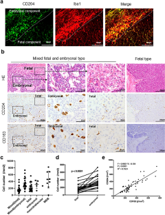 M-CSFR expression in the embryonal component of hepatoblastoma and cell-to-cell interaction between macrophages and hepatoblastoma