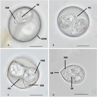 Brief report: Isospora gilvusi n. sp. (Apicomplexa: Eimeriidae) from the warbling vireo Vireo gilvus Vieillot (Passeriformes: Vireonidae) in Morelia, Mexico.