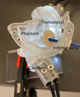 Quantification of Mechanical Characteristics of Conventional Steerable Ablation Catheters for Treatment of Atrial Fibrillation Using a Heart Phantom.