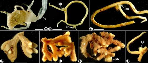 Mycorrhizal structures in mycoheterotrophic Thismia spp. (Thismiaceae): functional and evolutionary interpretations