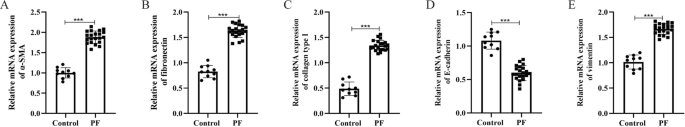 MAP3K19 Promotes the Progression of Tuberculosis-Induced Pulmonary Fibrosis Through Activation of the TGF-β/Smad2 Signaling Pathway.