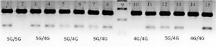 Plasminogen Activator Inhibitor-1 4G/5G Promoter Polymorphism in Indian Patients with Deep Vein Thrombosis.