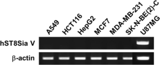 Regulatory mechanism for the human glioblastoma cell-specific expression of the human GD1c/GT1a/GQ1b synthase (hST8Sia V) gene.