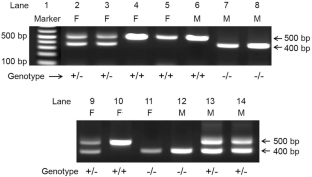 The effect of gender and obesity in modulating cross-bridge function in cardiac muscle fibers.