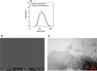 Preparation and Evaluation of Anti-Cancer Effect of Lactobacillus Casei-Containing Niosome on Breast Cancer Cells Viability