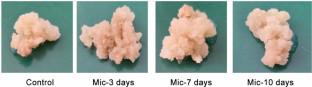 Alteration in the callogenesis, tropane alkaloid formation, and gene expression in Hyoscyamus niger under clinorotation.