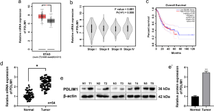 PDLIM1 interacts with HK2 to promote gastric cancer progression through enhancing the Warburg effect via Wnt/β-catenin signaling.