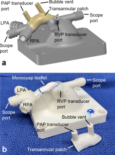 Systematic Analysis of PTFE Monocusp Leaflet Design in a Patient-Based 3D in-Vitro Model of Tetralogy of Fallot.