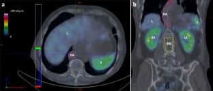 Clinical Pharmacokinetics of Radiopharmaceuticals from SPECT/CT Image Acquisition by Contouring in Patients with Gastroenteropancreatic Neuroendocrine Tumors: Lu-177 DOTATATE (Lutathera<sup>®</sup>) Case.