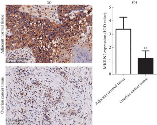 Overexpression of MKRN2 Inhibits the Growth of Ovarian Cancer Cells