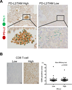 PD-L2 overexpression on tumor-associated macrophages is one of the predictors for better prognosis in lung adenocarcinoma.