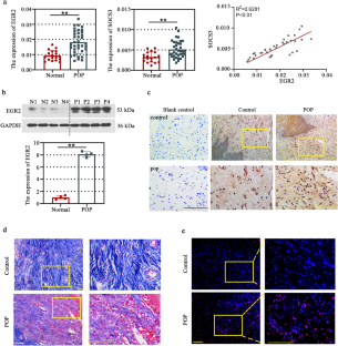 Early growth response 2, a novel target of pelvic organ prolapse, is highly expressed in anterior vaginal wall tissues with pelvic organ prolapse.