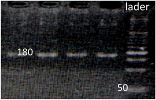 Analysis of Programmed Cell Death-1 (PD-1) Gene Variations (re11568821 and rs41386349) in HTLV-1 Infection Using One Primer Pair and Proviral Load.