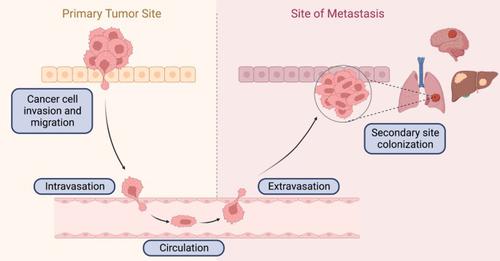 Cancer metastasis under the magnifying glass of epigenetics and epitranscriptomics.