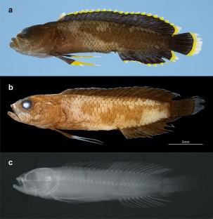 Description of a new species of Acanthoplesiops (Plesiopidae: Acanthoclininae) from the Kerama Islands, Ryukyu Islands, southern Japan