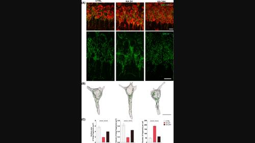 Morphological alterations of the neuronal Golgi apparatus upon seizures.