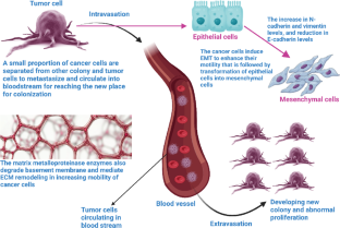 Molecular profile of metastasis, cell plasticity and EMT in pancreatic cancer: a pre-clinical connection to aggressiveness and drug resistance.