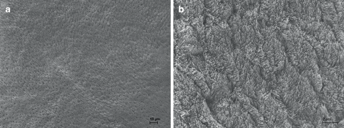 Effect of argon cold plasma composition on orthodontic bonding-new insights into input parameters and protocols.