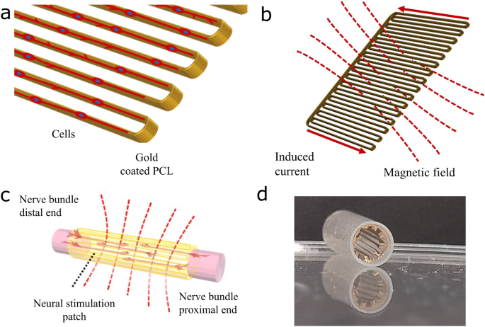 Wireless electromagnetic neural stimulation patch with anisotropic guidance