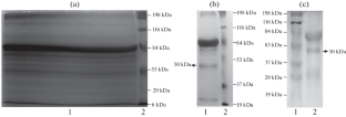 Identification and Characterisation of a Novel Phosphatidylinositol-Specific Phospholipase C Having Implications in the Pathogenesis of Leptospirosis