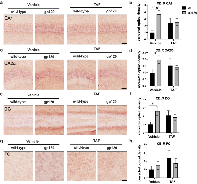 GP120 and tenofovir alafenamide alter cannabinoid receptor 1 expression in hippocampus of mice.