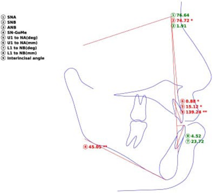 Preciseness of artificial intelligence for lateral cephalometric measurements.