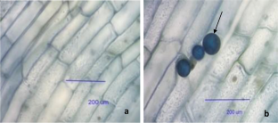 Growth promoting effects of endophytic fungus Piriformospora indica in small cardamom (Elettaria cardamomum Maton)