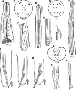 Two new and one newly recorded gonad-infecting species of Philometra Costa, 1845 (Nematoda: Philometridae) parasitising marine fishes in Iraq.