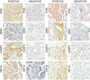 Protein Expression of PI3K/AKT/mTOR Pathway Targets Validated by Gene Expression and its Correlation with Prognosis in Canine Mammary Cancer.