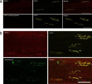 Activation of TRPV1 Channels Inhibits the Release of Acetylcholine and Improves Muscle Contractility in Mice.