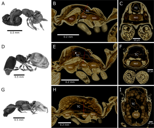 Evidence of a thoracic crop in workers, soldiers, and queens of Carebara perpusilla ants (Formicidae: Myrmicinae)