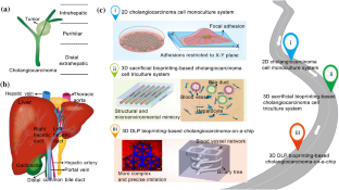 3D-bioprinted cholangiocarcinoma-on-a-chip model for evaluating drug responses